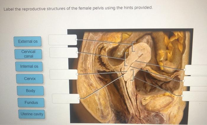 Solved Label The Reproductive Structures Of The Female Chegg Com