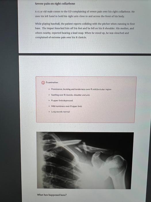 Solved Severe pain on right collarbone A 15 yr old male