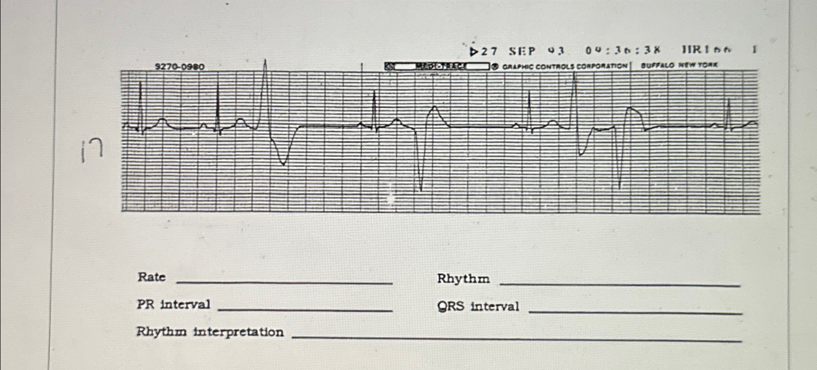 Solved Rate .RhythmPR intervalQRS interva.Rhythm | Chegg.com