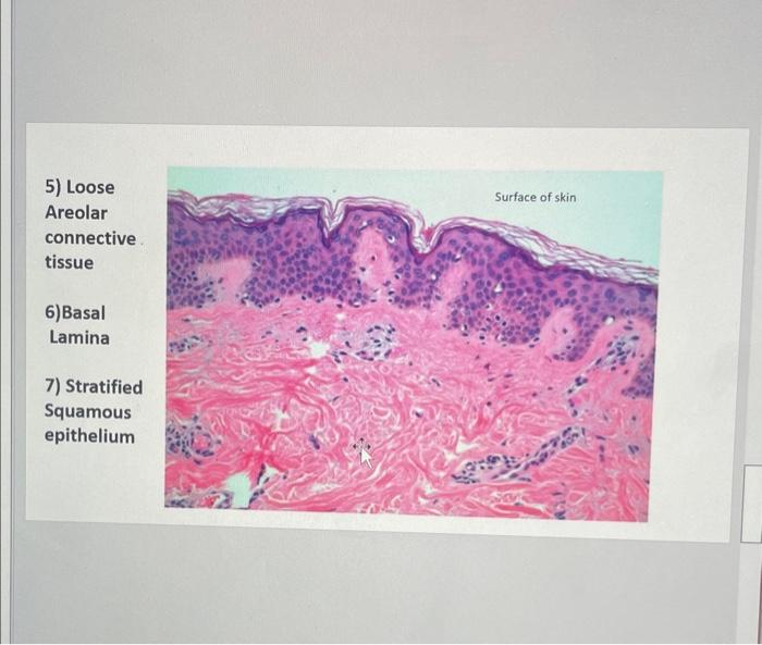 Solved 5) Loose Areolar connective tissue 6)Basal Lamina 7) | Chegg.com