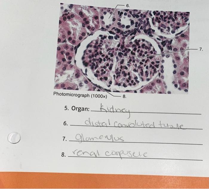 2. Complete the labeling activity in FIGURE 24,18 hu | Chegg.com