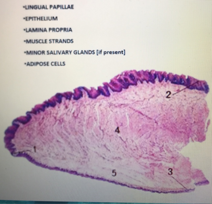 Solved Ate And Label The Following: •TASTE BUDS EPITHELIUM | Chegg.com