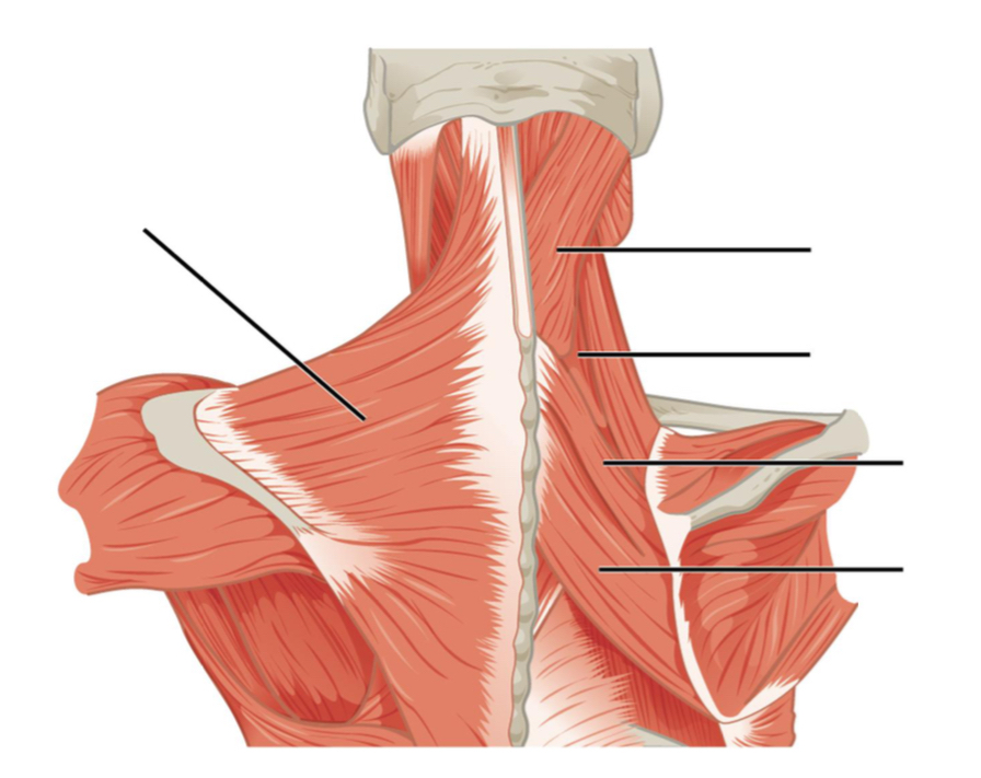 Solved Please label the indicated muscles on the diagram | Chegg.com