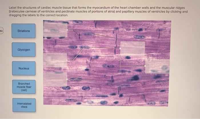 cardiac muscle cell labeled