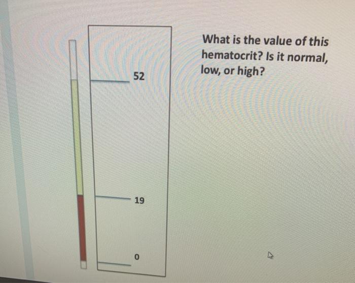 What is the value of this hematocrit? Is it normal, low, or high? 52 19 0