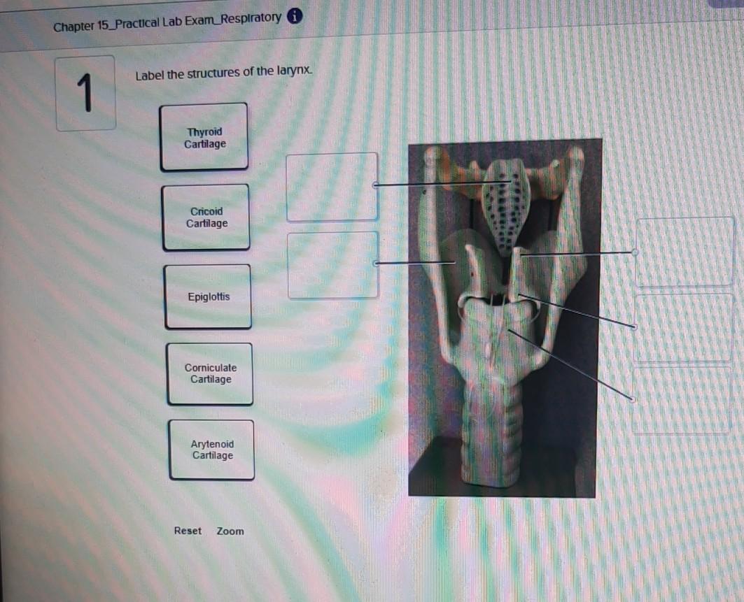 Solved Chapter 15_Practical Lab Exam Respiratory Label the | Chegg.com