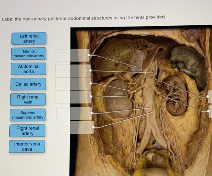 Solved Label the nonurinary posterior abdominal structures