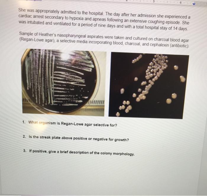 Solved Week 14 Case Study Heather, a three weekold