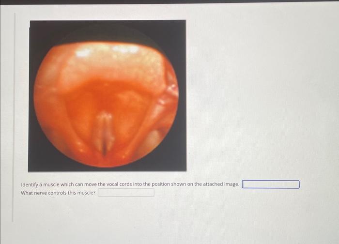 Solved Identify a muscle which can move the vocal cords into | Chegg.com