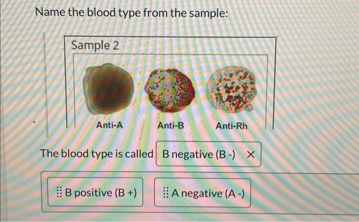 Solved Name The Blood Type From The Sample: Sample 2 Anti-A | Chegg.com