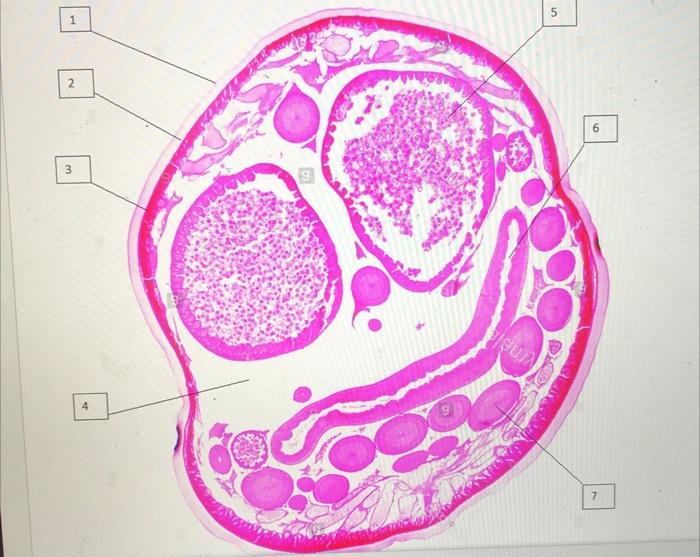 Solved Label the image below