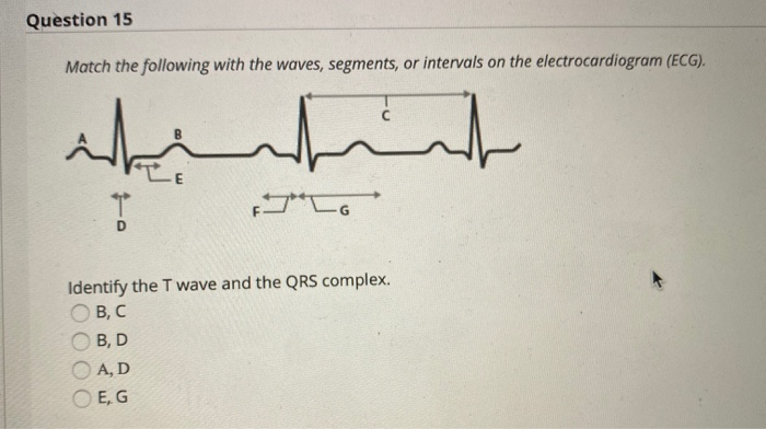 Solved Question 15 Match The Following With The Waves, | Chegg.com