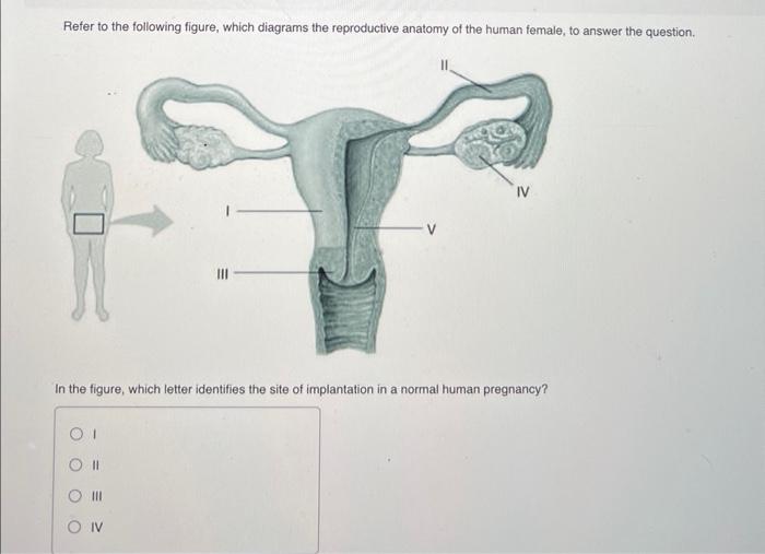 Solved Refer to the following figure, which diagrams the | Chegg.com