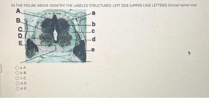 Solved IN THE FIGURE ABOVE IDENTIFY THE LABELED STRUCTURES: | Chegg.com