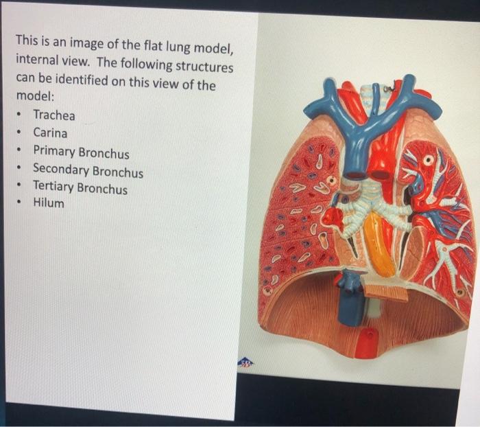 This is an image of the flat lung model, internal view. The following structures can be identified on this view of the model: