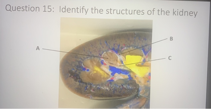 Solved Question 15: Identify the structures of the kidney | Chegg.com