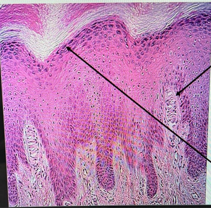 Solved Identify the structure that is shown at the tip of | Chegg.com