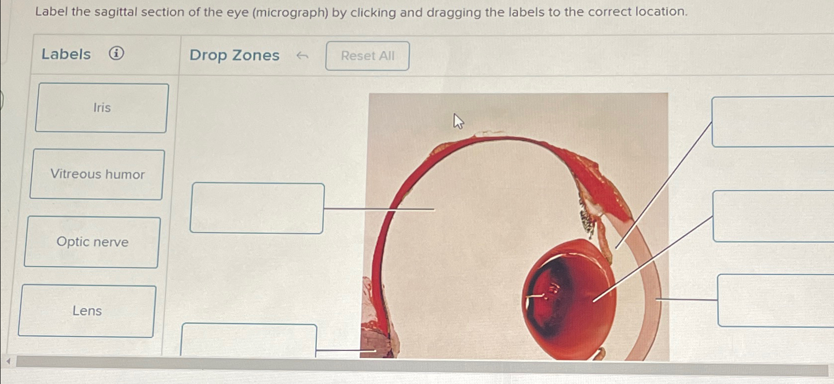 Solved Label the sagittal section of the eye (micrograph) | Chegg.com