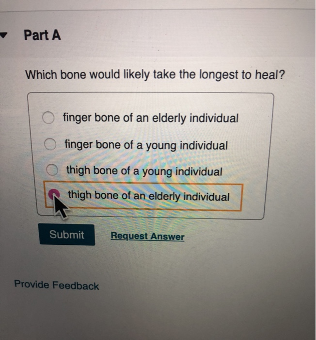 Which Bone Would Likely Take the Longest to Heal-Bone Recovery Time Explained