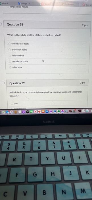 Solved Question 26 2 pts Which dural partition extends into | Chegg.com