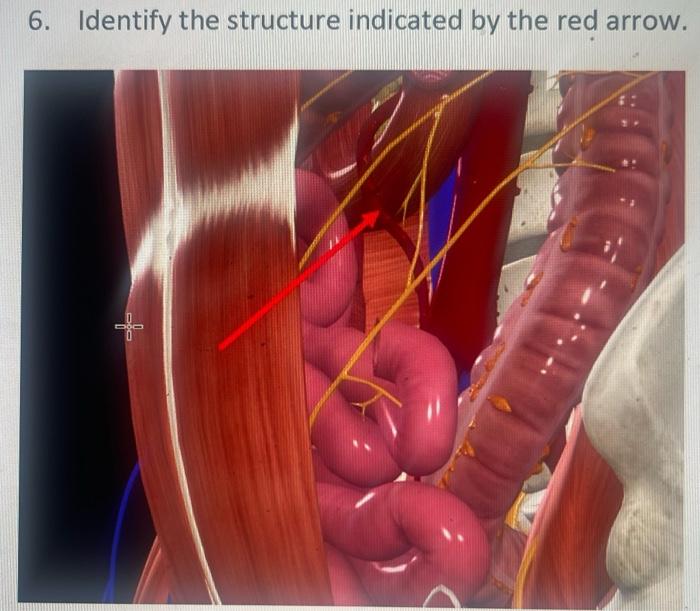 6. Identify the structure indicated by the red arrow.