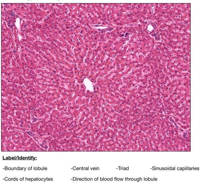 Solved Label/Identify the following structures found in a | Chegg.com