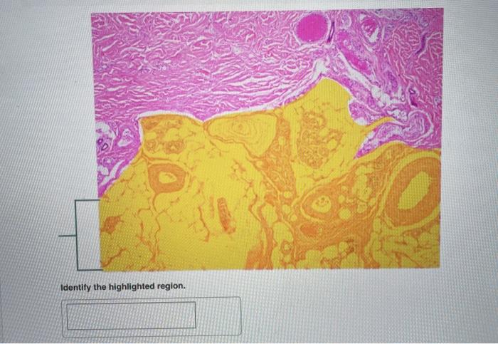 Solved Identify the highlighted region. | Chegg.com