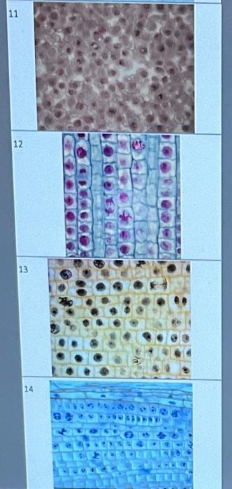 Solved 1 For each of the 14 images list the mitotic stages Biology Diagrams