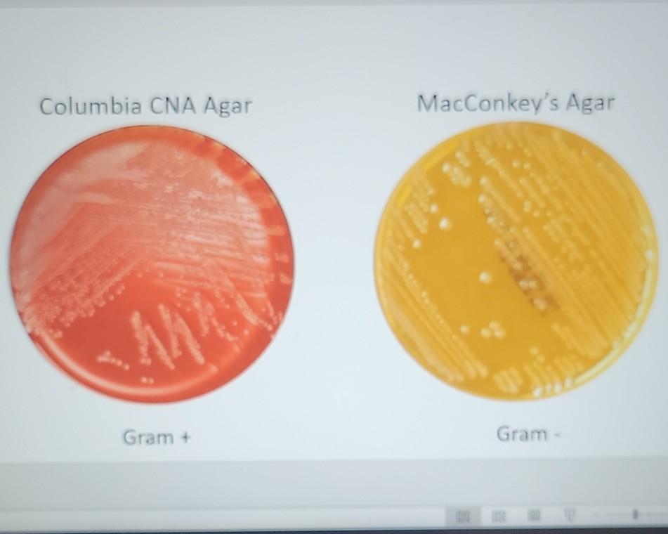 solved-columbia-cna-agar-macconkey-s-agar-gram-gram-chegg
