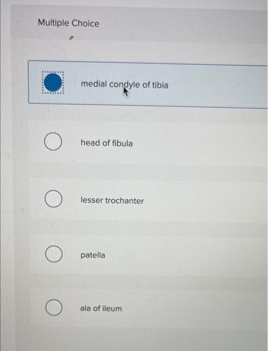 Solved What Is The Insertion Of The Highlighted Muscle? | Chegg.com