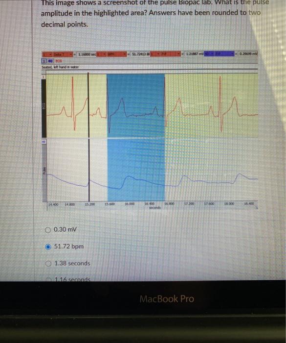 This image shows a screenshot of the pulse Biopac lab. What is the pulse amplitude in the highlighted area? Answers have been