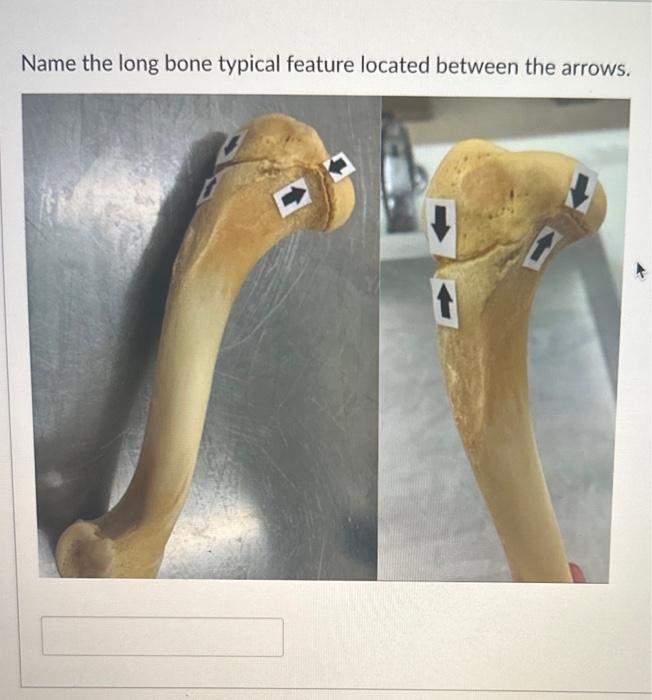 Solved indicated by the green lines. Name the specific bony | Chegg.com