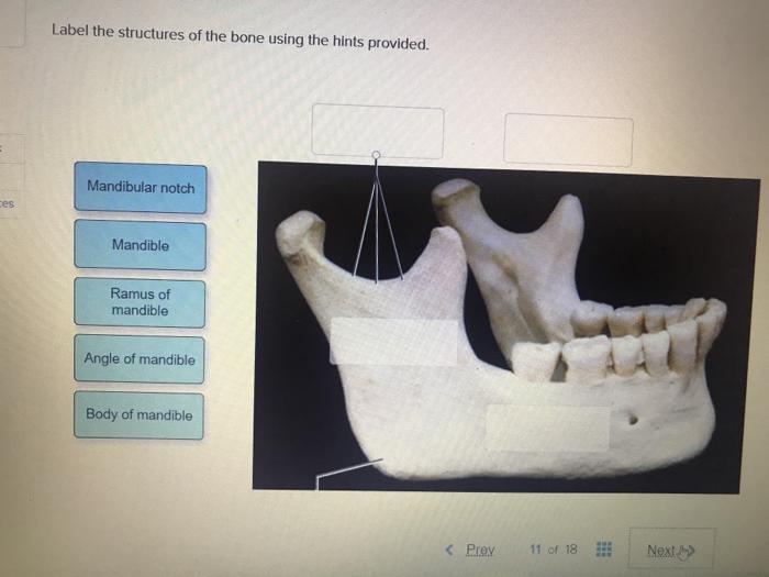 Solved Label the structures of the bone using the hints | Chegg.com