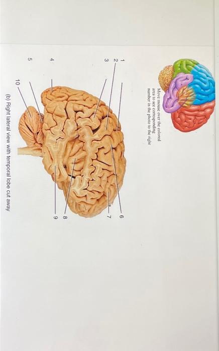 Solved (b) Right lateral view with temporal lobe cut away | Chegg.com