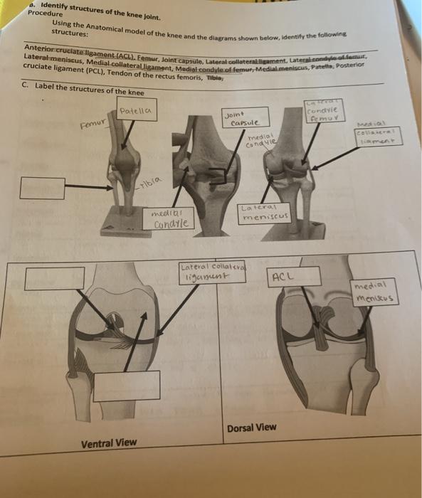 Solved 8. Identify structures of the knee joint. Procedure | Chegg.com