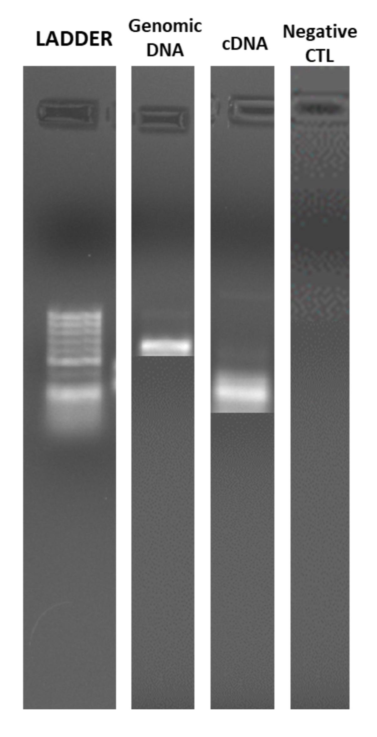 Solved Find PCR products, length?Explain what negative | Chegg.com