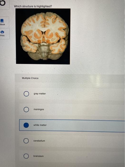 Solved Which structure is highlighted? Multiple Choice