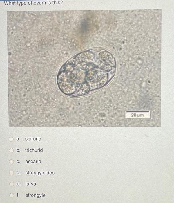 What type of ovum is this?
a. spirurid
b. trichurid
c. ascarid
d. strongyloides
e. larva
f. strongyle