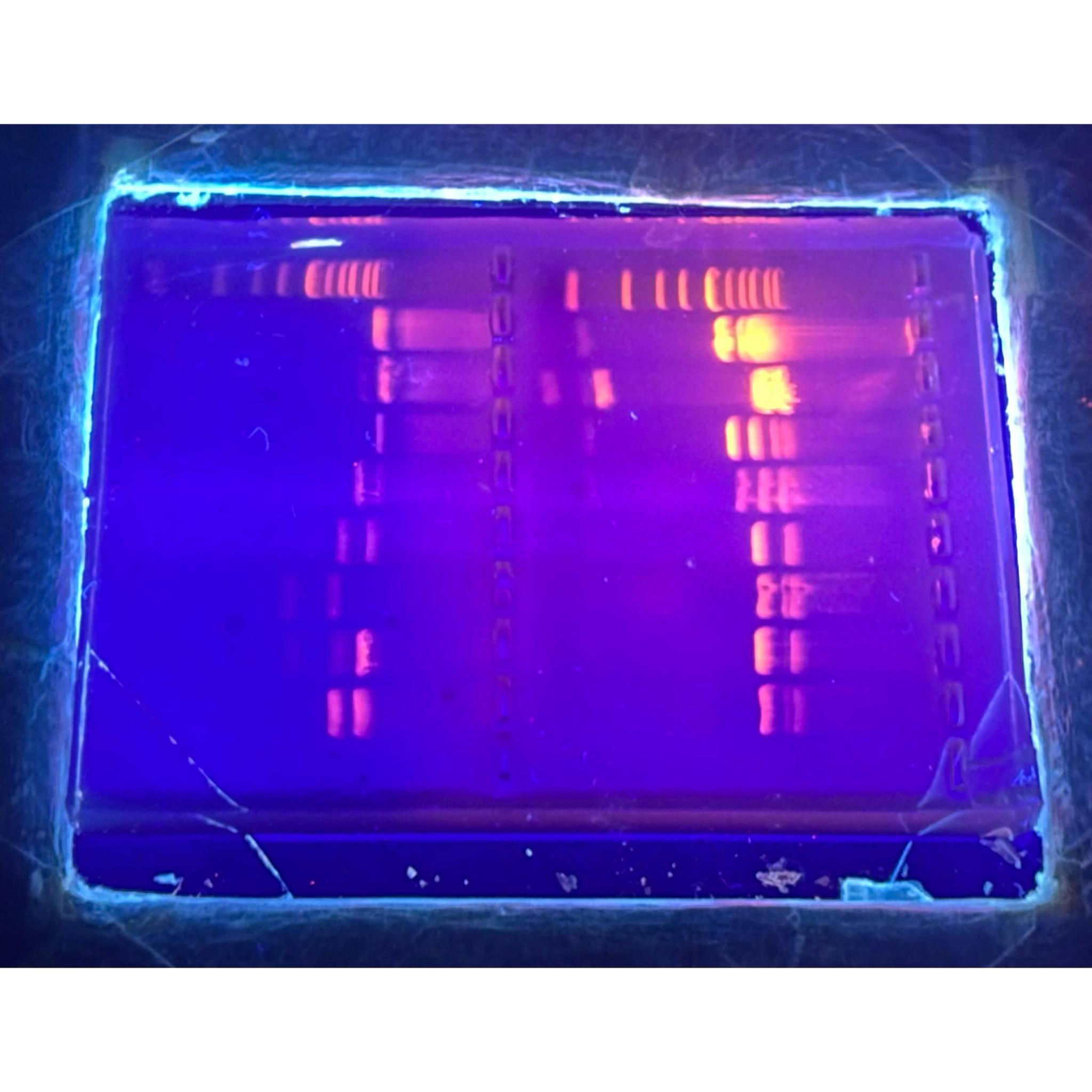 Solved What can we say by analyzing this Agarose gel | Chegg.com