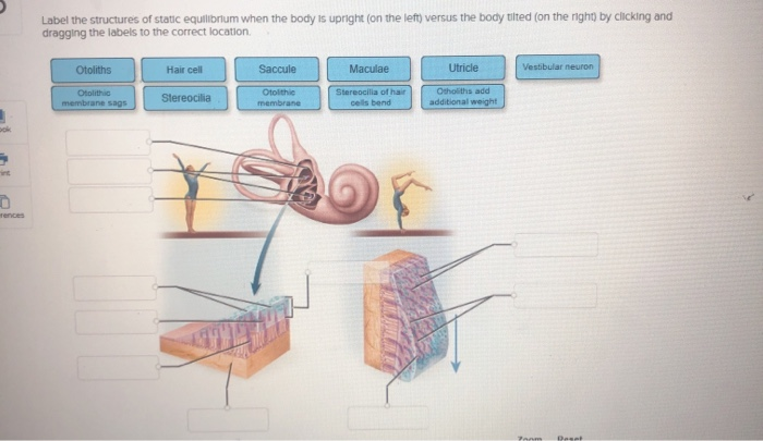 solved-label-the-structures-of-static-equilibrium-when-the-chegg