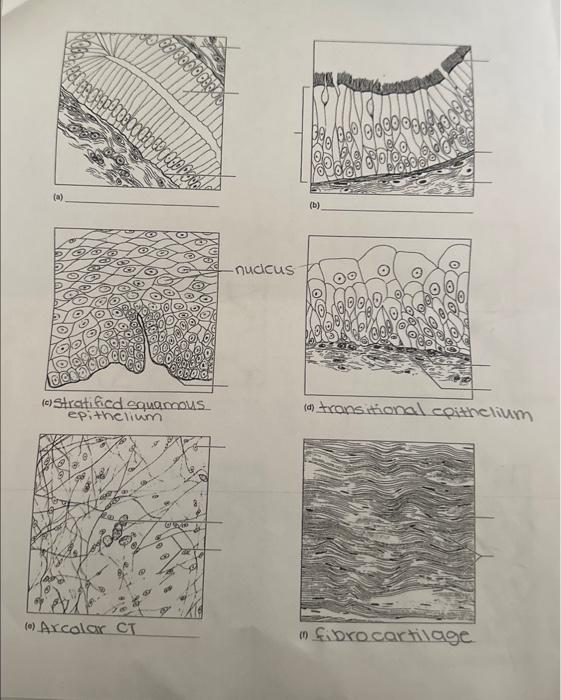 (c) Stratificd squamous epithelium (d) transitional | Chegg.com