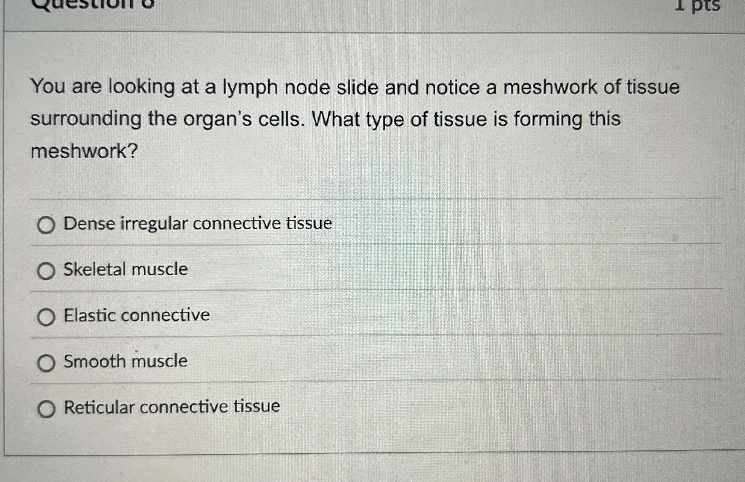 Solved You are looking at a lymph node slide and notice a | Chegg.com