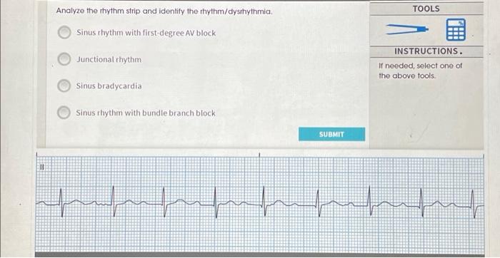 junctional bradycardia rhythm strip