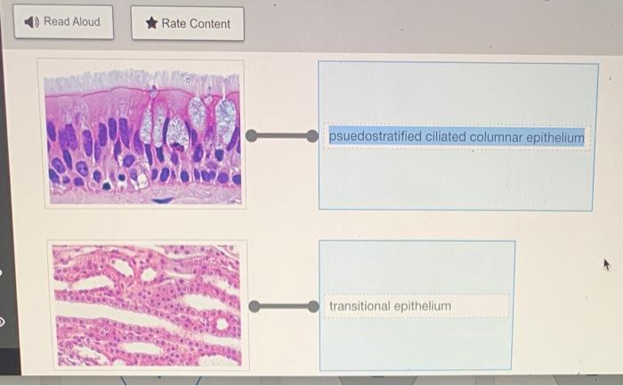 Solved Rearrange the epithelium types to correspond to the | Chegg.com