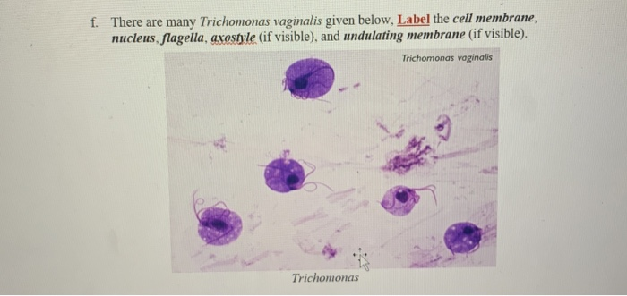 Solved f. There are many Trichomonas vaginalis given below, | Chegg.com