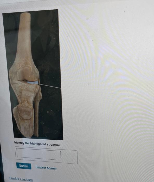 L: Cadaver > Appendicular Skeleton: Joints > Lab | Chegg.com