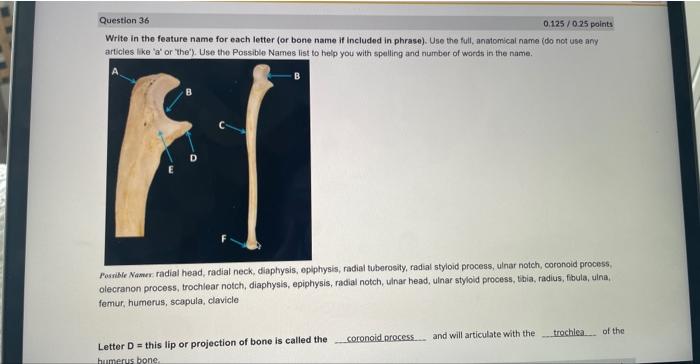 Solved Write in the feature name for each letter (or bone | Chegg.com