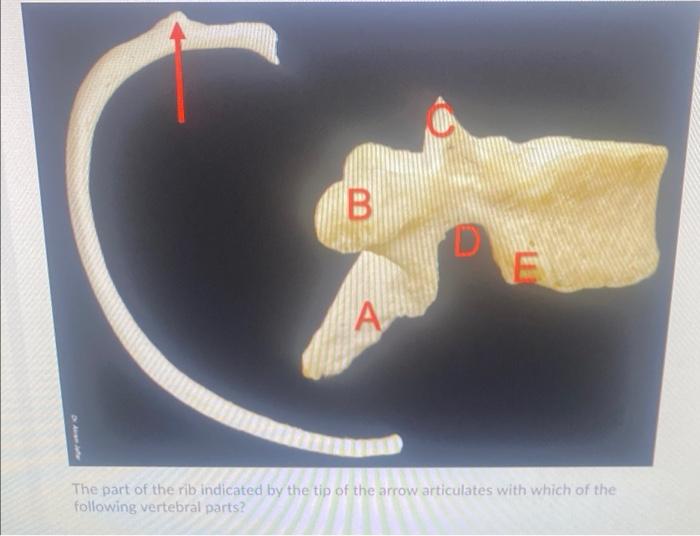 Solved B A The part of the rib indicated by the tip of the | Chegg.com