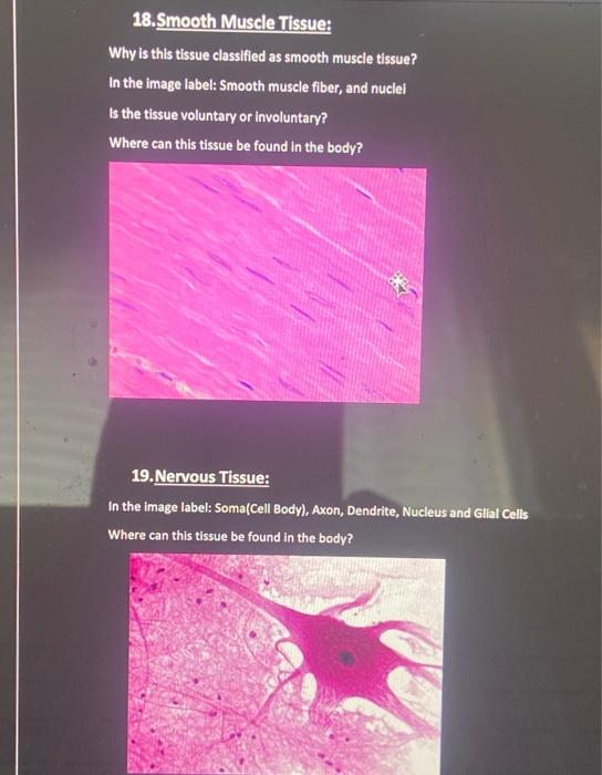 18. Smooth Muscle Tissue: Why is this tissue classified as smooth muscle tissue? In the image label: Smooth muscle fiber, and