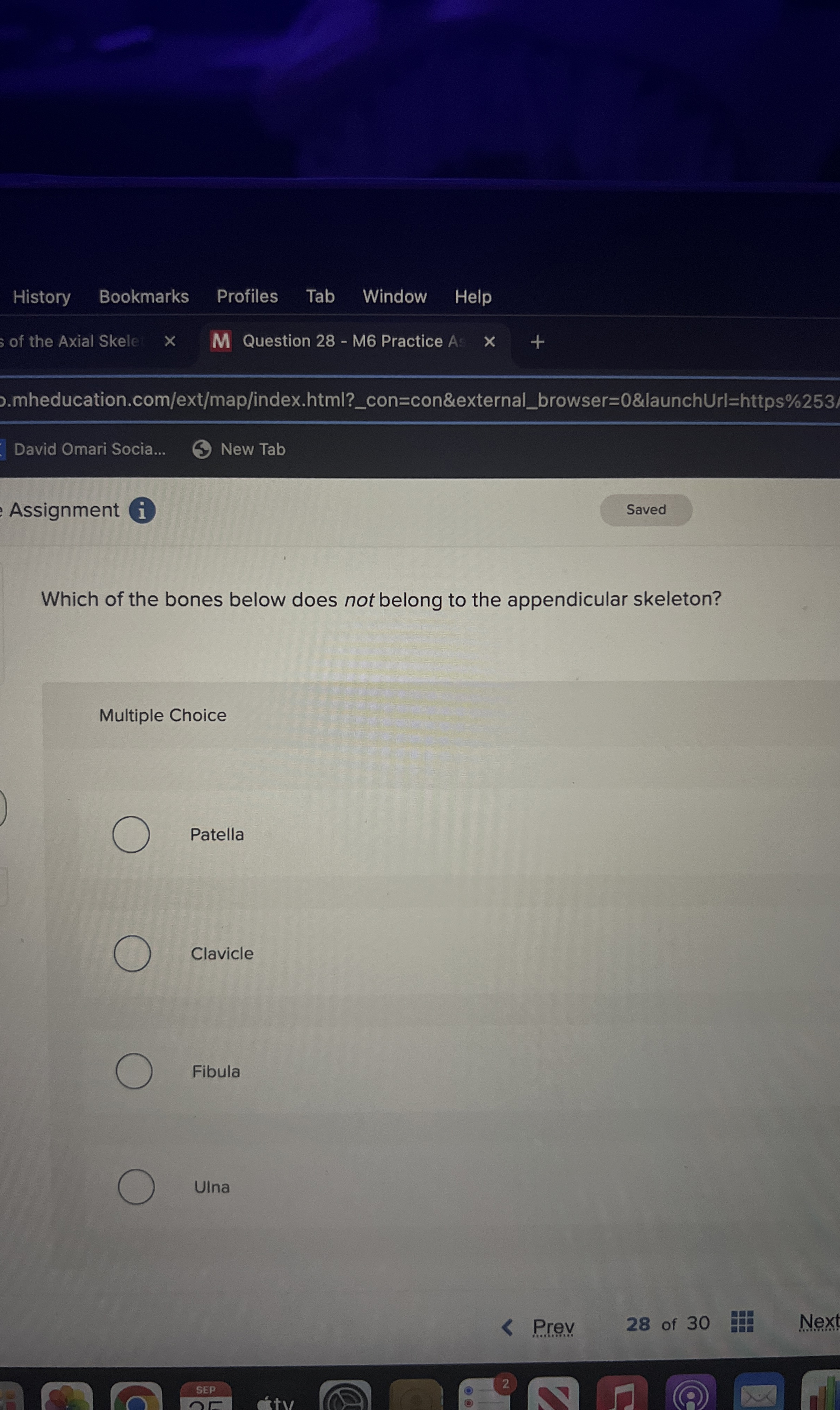Solved Which of the bones below does not belong to the